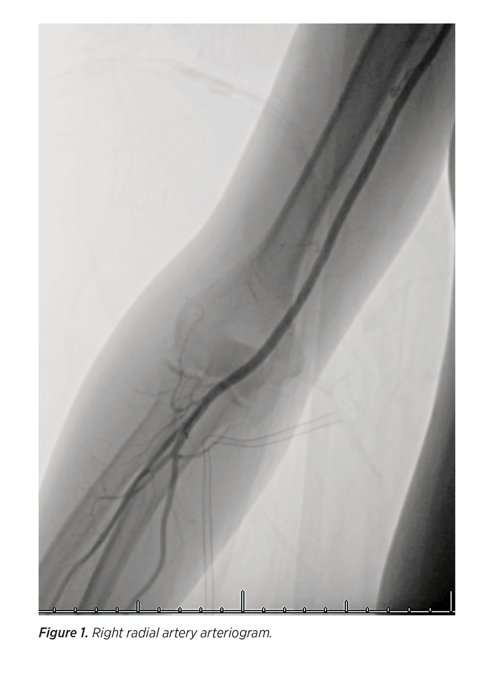 Get Transitioning Neuroendovascular Practice Upmc Physician Resources For iPhone Wallpaper Transitioning Neuroendovascular Practice Upmc Physician Resources For iPhone